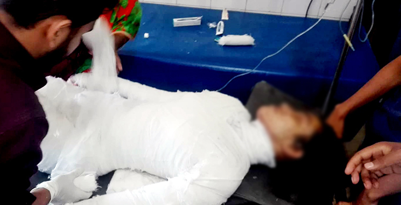 অধ্যক্ষের উপর অভিযোগ গায়ে আগুন দেয়া সেই ছাত্রীর
